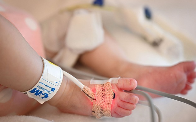 Náročná operace. V Motole transplantovali srdce miminku, rok bylo na přístrojích