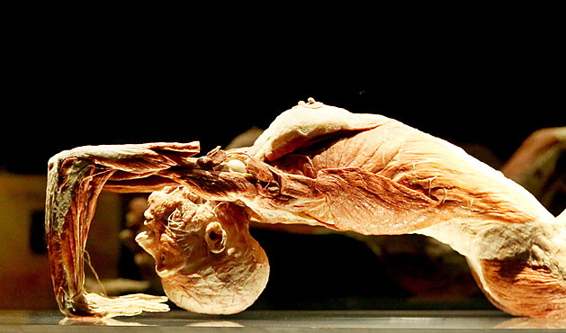Zemřel kontroverzní anatom von Hagens. I on si přál, aby jeho mrtvé tělo vystavili